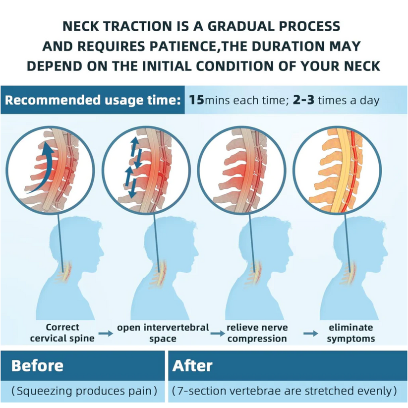 Cilious Gen-2 Neck Traction Collar